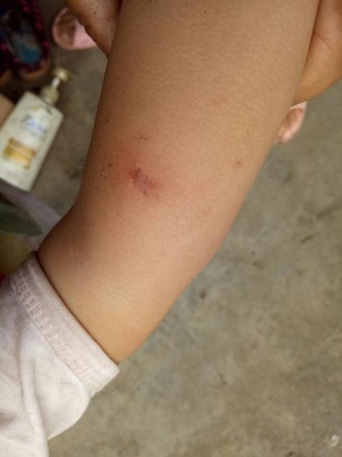 头条问答 晚上睡觉时浑身发痒 是怎么回事 135个回答