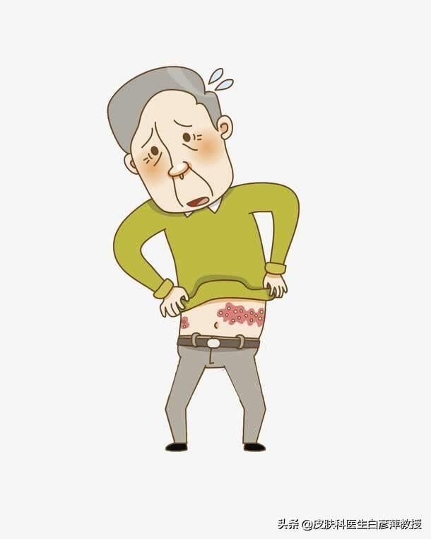 疱疹肺炎严重吗:疱疹病毒性肺炎 带状疱疹长在头上会有后遗症吗？