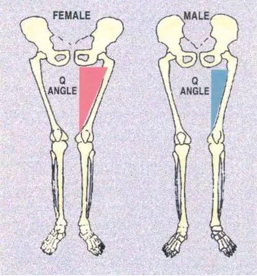 怎么矫正XO型腿，女生腿不直怎么办有什么矫正办法