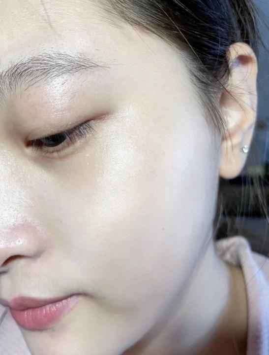 如何改善毛孔粗大:如何真正改善"毛孔粗大"