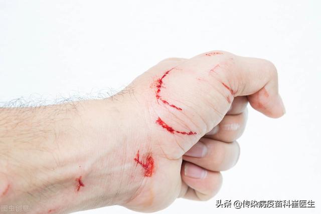 科学家找到抑制狂犬病毒关键开关:前三天被家猫抓了，昨天打了新冠疫苗，现在能打狂犬病疫苗吗？ 科学家找到抑制狂犬病毒关键开关 新闻