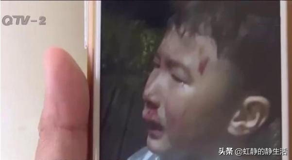 小孩狗:青岛一6岁男童被狗惊倒，满脸是血，狗主人扬长而去，怎么回事？ 小孩狗都嫌的年龄