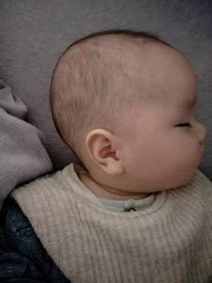 宝宝的头多久就定型了，火急！婴儿要不要睡头型，什么时候可以睡？