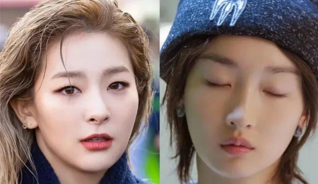戚薇回应割双眼皮:为什么现在的女孩，已经长得很漂亮了还去整容