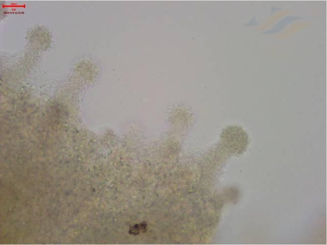 乌鱼诺卡氏菌病图片:生鱼诺卡氏菌病怎么治疗 草鱼丝囊霉菌感染用什么药？