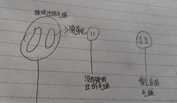 产后腹直肌分离、骨盆前倾,怎么做才能修复？