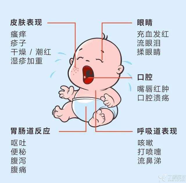 头条问答 - 孩子老是过敏咋办,愁人?(35个回答)