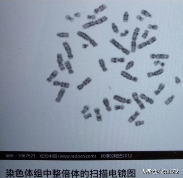 神经遗传病有哪些症状:神经病是指什么？情绪不好会得病吗？