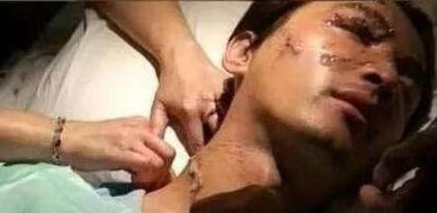 任家萱烧伤图片:范玮琪摔伤下巴缝了15针，如何看待明星网上晒受伤的行为
