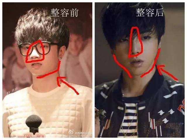 高俊熙整容前后:华晨宇的外貌为什么感觉变了很多？