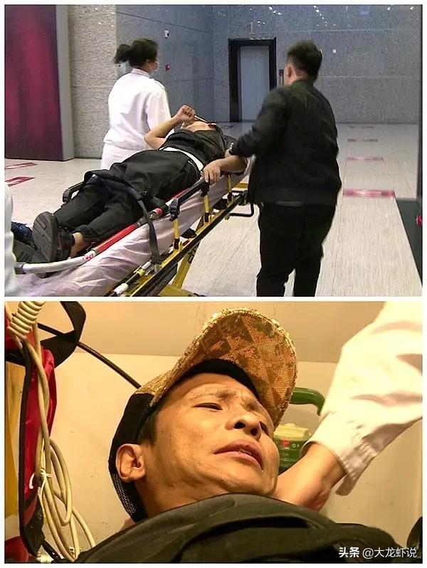 宋小宝肝硬化:肝脏受损会有什么样的临床表现？