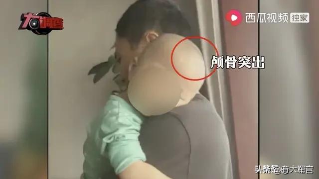 近日湖南多名婴儿喝假奶粉成大头娃娃引发关注商家为什么要这么做？