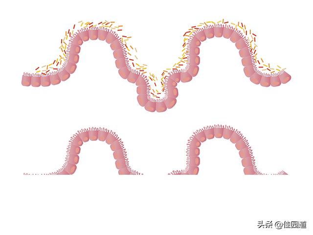 拉肚子肠胃不适吃什么药:肠胃不好，整天拉肚子吃什么胃药好呢？ 拉肚子肠胃不适吃什么药好