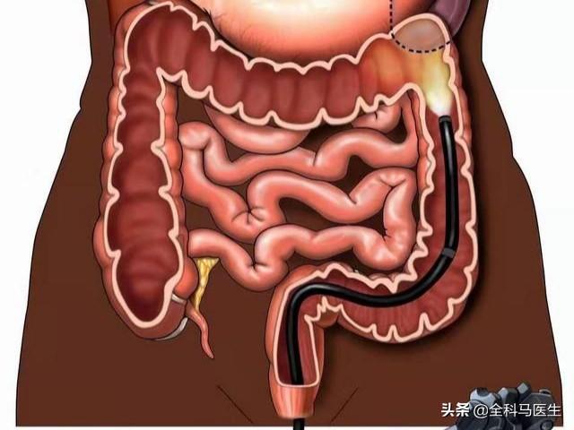 大便不成型拉不干净是什么原因:大便潮湿不成型，擦不干净怎么办？