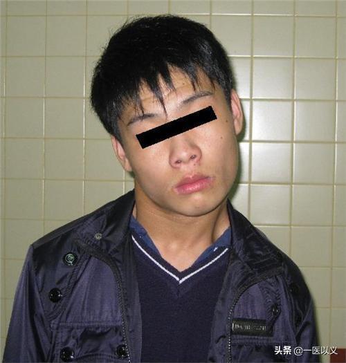 歪脖子怎么办:两个半月的宝宝轻微斜颈怎么办