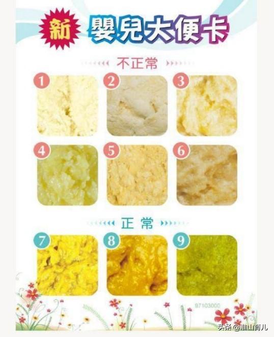 宝宝胆道阻塞拉屎图片:新生儿大便中有奶瓣是消化不好吗？应该如何帮宝宝调理身体？