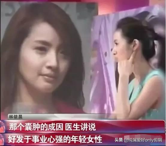 林依晨的老公是谁:如何评价林依晨本人及其演技？