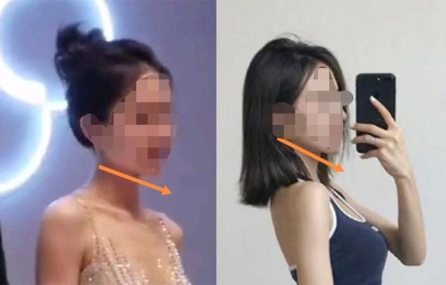 fx组合郑水晶整容:项思醒的整容做下来要多少钱？