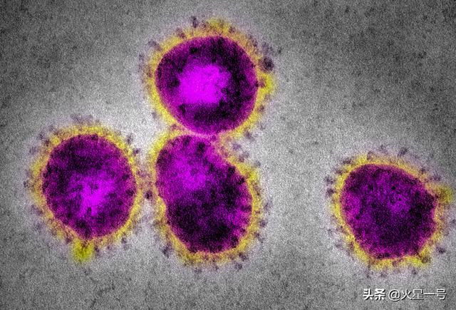 为什么新冠病毒，比SARS更容易传播？