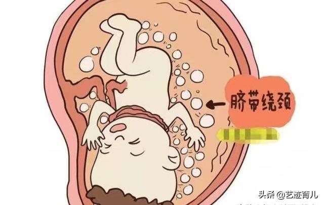 胎儿缺氧的表现有哪些，当胎儿缺氧，往往有哪些临床表现