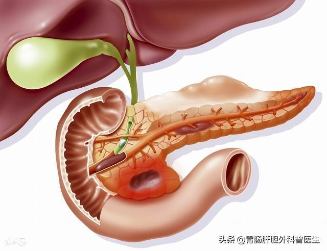 胆囊息肉可以喝红酒吗，胆囊息肉哪些食物不可以吃？