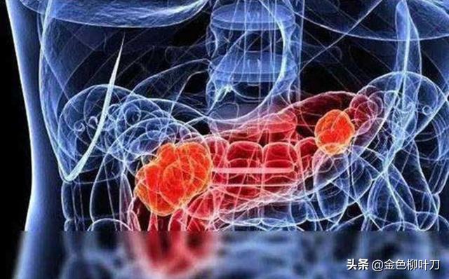 乔布斯胰腺癌:胰腺癌一般哪里会出现疼痛