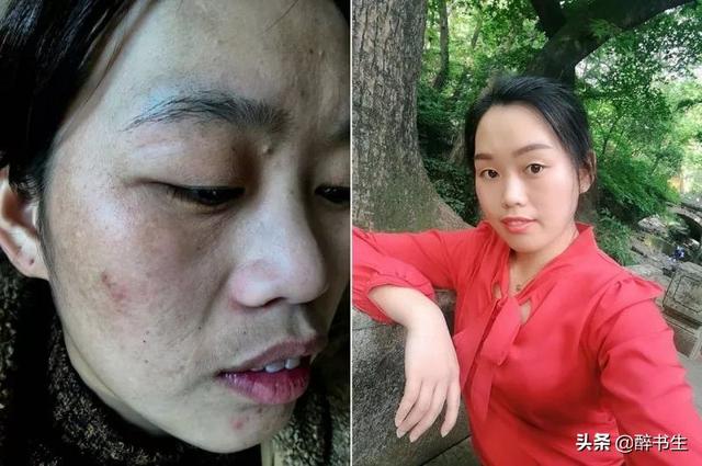 头条问答 - 脸变黑的原因是什么呢?(2个回答)