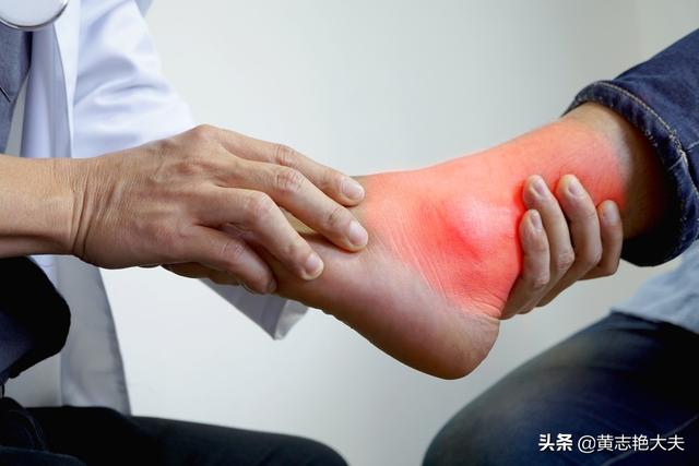 尿酸一高睡觉会有哪些症状严重吗