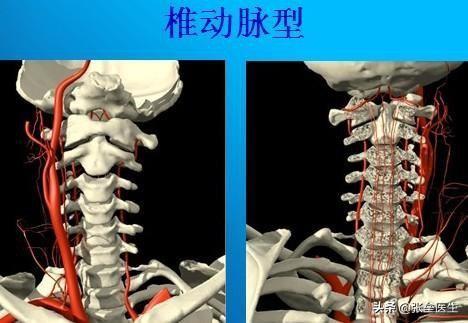 脊椎病的症状都有哪些:颈椎病的症状都有哪些 脊椎病会引起头痛头晕吗？