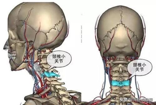 颈椎不好要不要睡枕头?