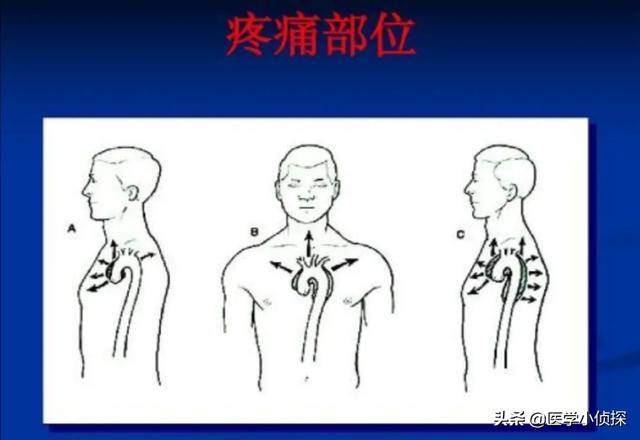 先天性心脏病的症状:先天性心脏病的症状有哪些呢 小儿先天性心脏病平时有什么反应？