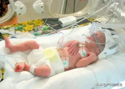 患儿可能遗留不可逆性脑损害，新生儿出生有重度窒息，这个后期会有什么后遗症吗