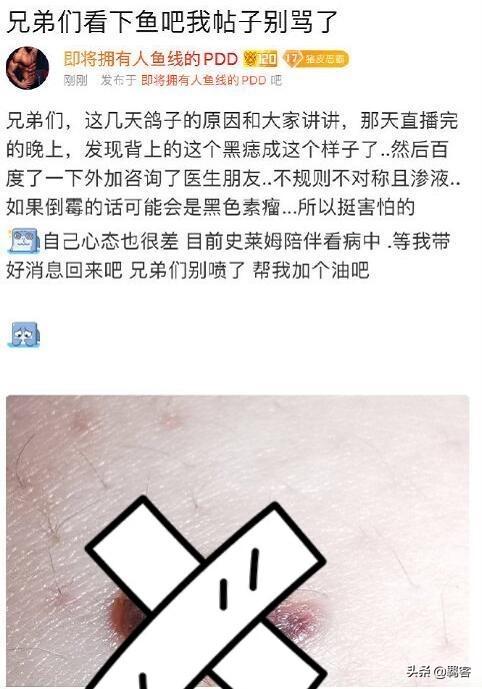 PDD正式宣布再次停播,“仅仅复播一年,就再次准备手术”,你怎么看？