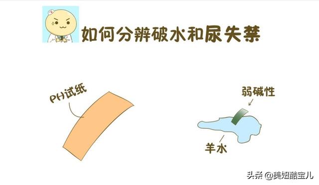 头条问答 孕晚期总是流水 会是羊水破了吗 二宝妈咪的育儿时光的回答 0赞