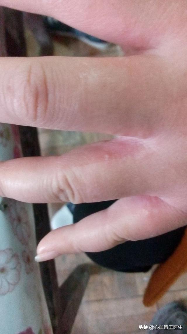 没有狗活不下去 下载:大龄剩女剩男，该怎么办？ 没有狗活不下去下载