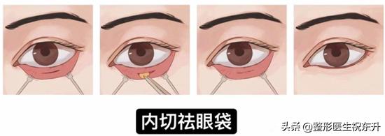 兰芝眼霜怎么样(兰芝眼霜图片)