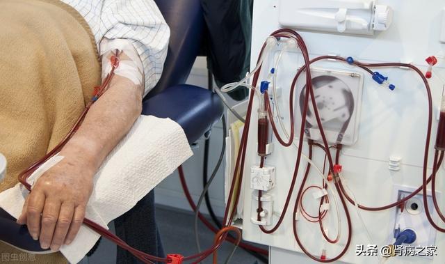 肾衰竭病人是否需要长时间的血液透析?有什么需要注意的吗?-百科网