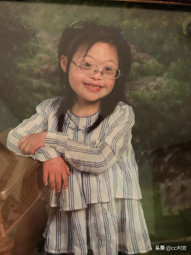 生育了一个唐氏综合征的宝宝我该如何面对