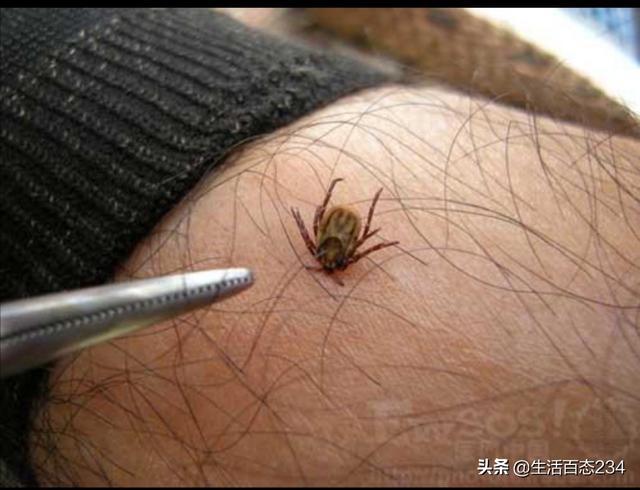 蜱虫有了解的吗？给科普下,好像还挺吓人的！会传染病毒是吧？