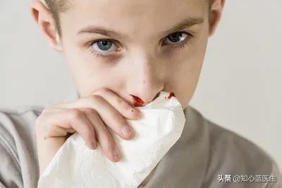 医学STIR是什么？:aptt医学上是什么意思 第4张