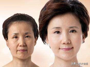法令纹深:法令纹的产生和睡姿有关吗，该如何预防法令纹呢