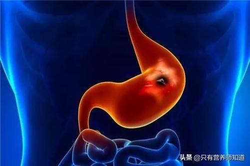 养胃效果最好的食物是什么,如果胃不好,应该怎么办？
