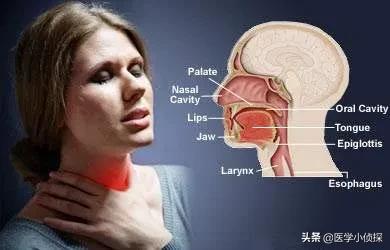 7莱姆病症状太容易被忽视:哪些症状连续出现是癌症的表现？