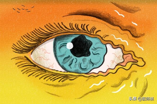 最近经常眼皮跳是什么原因，该怎么办？