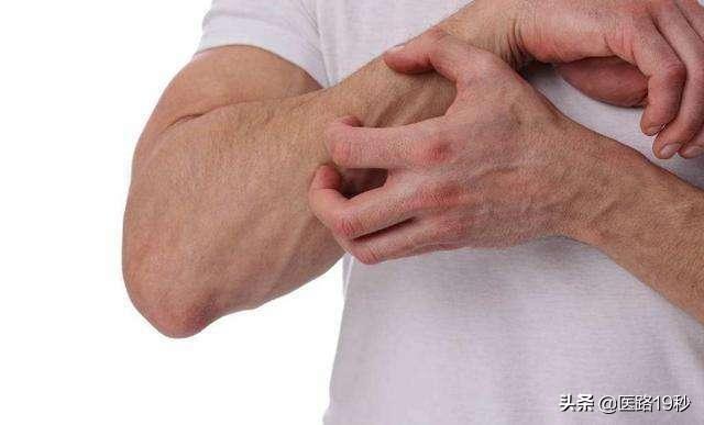 头条问答- 皮肤上的糖尿病信号是什么？(116个回答)