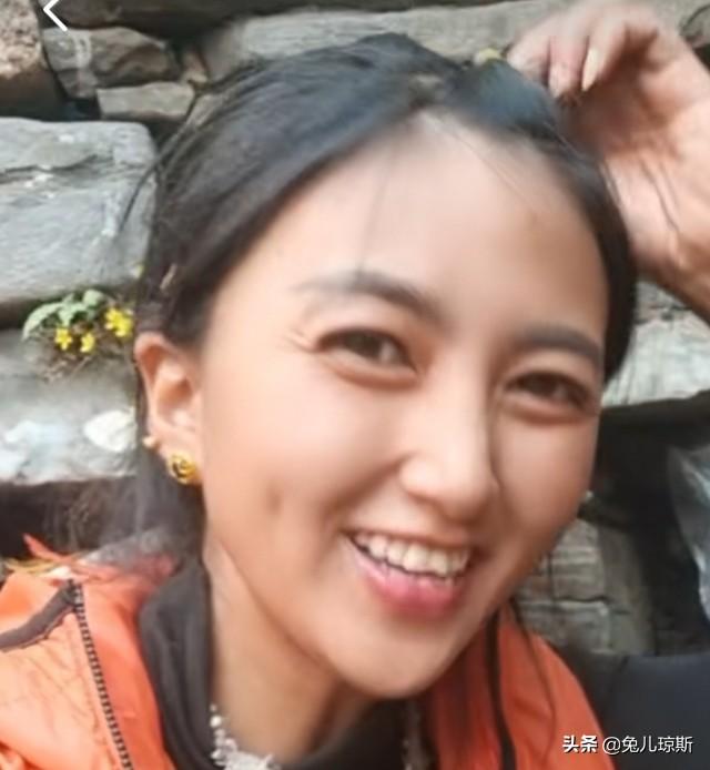 象人族女人:四川藏族姑娘“拉姆”被前夫重度烧伤！前夫心有多黑暗啊？