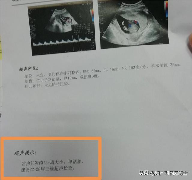 头条问答 请问怀孕早期阴道一直有持续性出血 腹部不痛 B超检查正常 请问这是什么原因引起 爱喝可乐的曦晴的回答 0赞