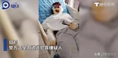 毁容女孩公开近照:3名女生被男生泼硫酸后，有些人竟然同情男生，为什么会这样？