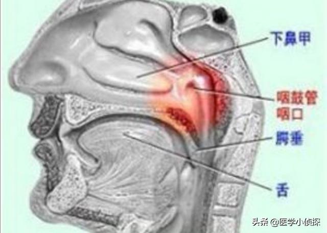 孕期耳朵里面很痒是怎么回事:耳朵里面总是痒是怎么回事？