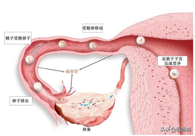 输卵管堵塞怎么治疗好;输卵管堵塞怎么治疗好得最快